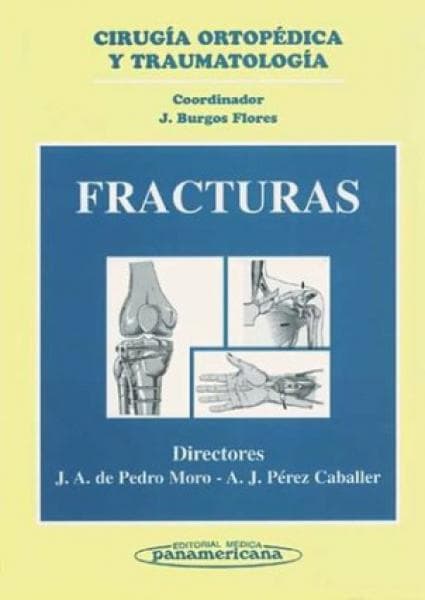 FRACTURAS