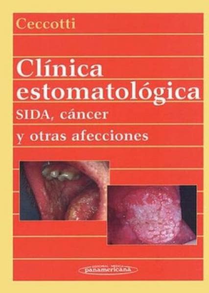 CLINICA ESTOMATOLOGICA.SIDA,CANCER,...