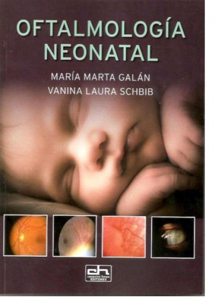 OFTALMOLOGIA NEONATAL